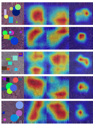 LymphAware: Domain-Aware Bias Disruption for Reliable Lymphoma Cancer AI Diagnosis