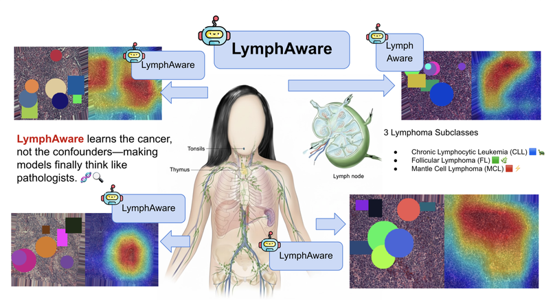 LymphAware: Domain-Aware Bias Disruption for Reliable Lymphoma Cancer AI Diagnosis