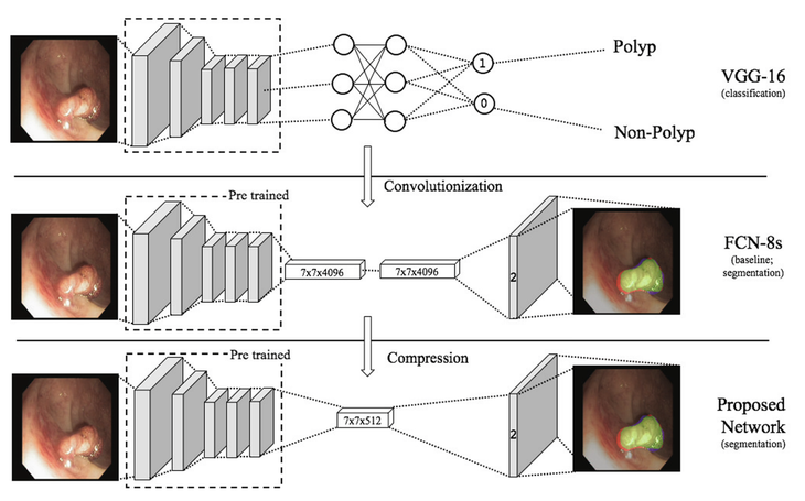 Real-Time Polyps Segmentation for Colonoscopy Video Frames Using Compressed Fully Convolutional Network