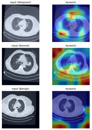 Seeing Isn't Always Believing: Analysis of Grad-CAM Faithfulness and Localization Reliability in Lung Cancer CT Classification